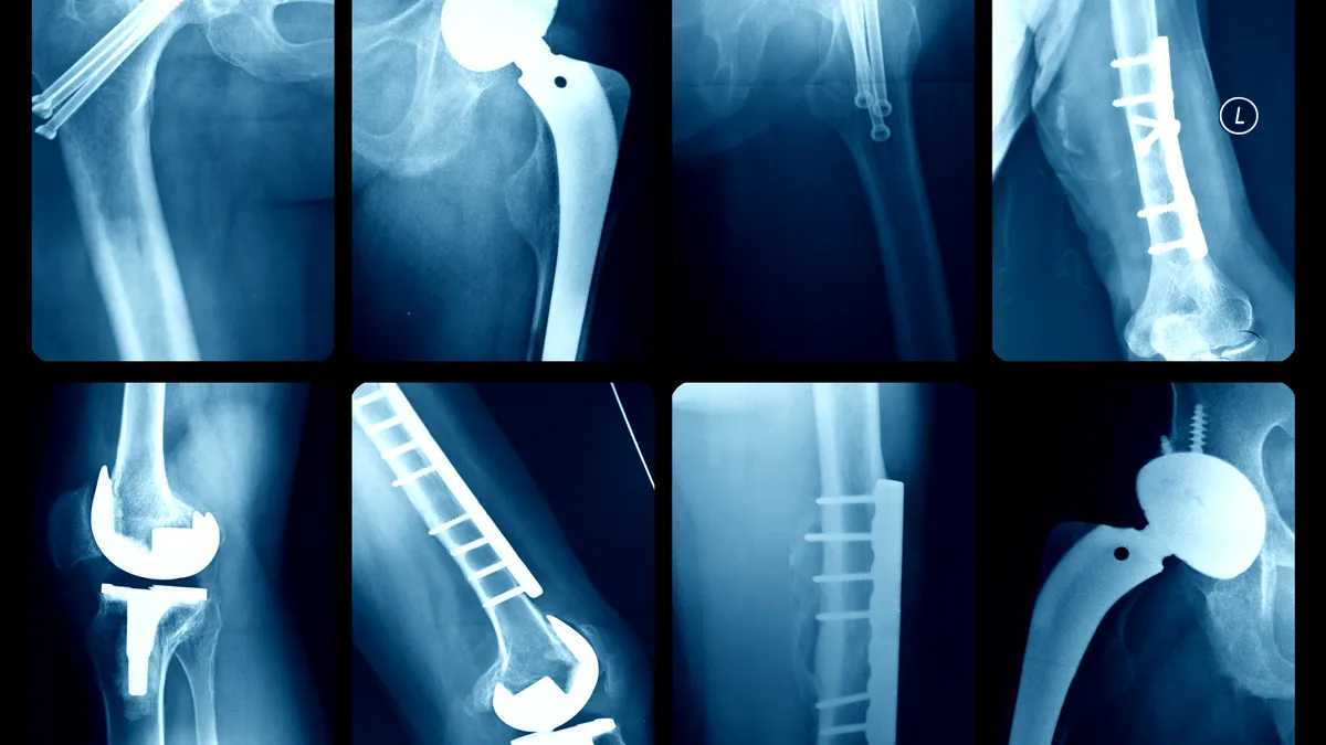 eight xray images side by side show rounded joints and pins in the hips and knees