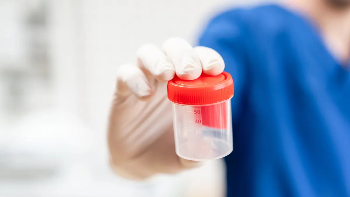 doctor in blue uniform and latex gloves is holding an empty plastic container for taking urine samples, light background. Medical concept.