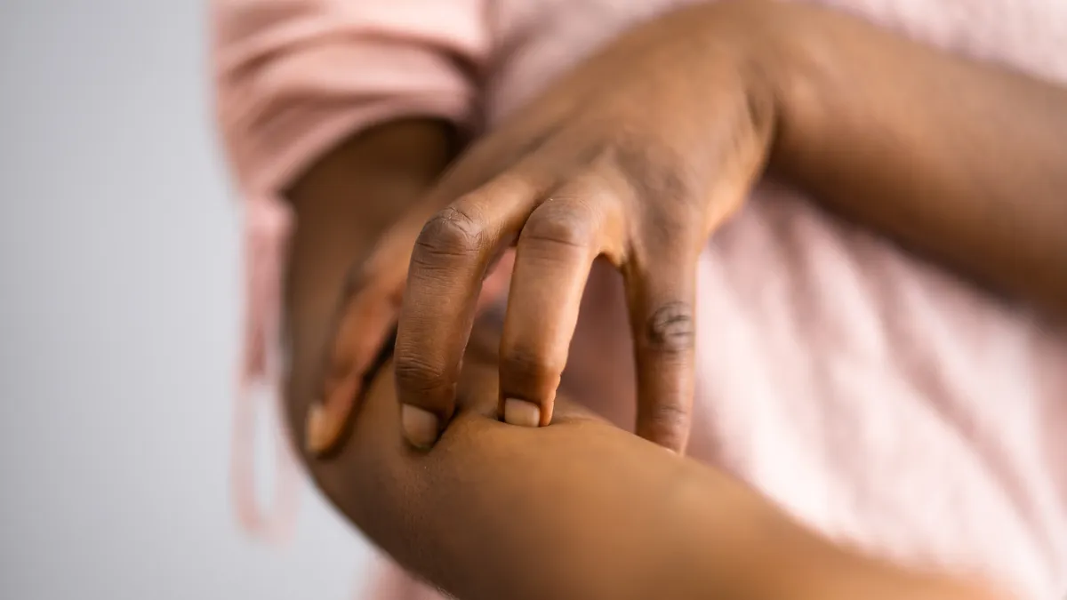 African American Woman With Itchy Skin. Allergy Or Psoriasis