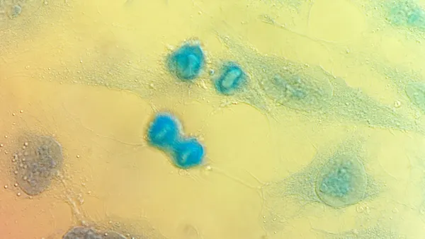 HeLa cervical cancer cells are seen stained blue against a yellow background.