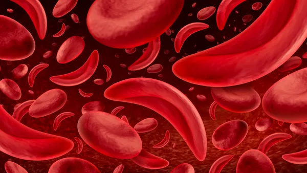An illustration of sickled and normal red blood cells.