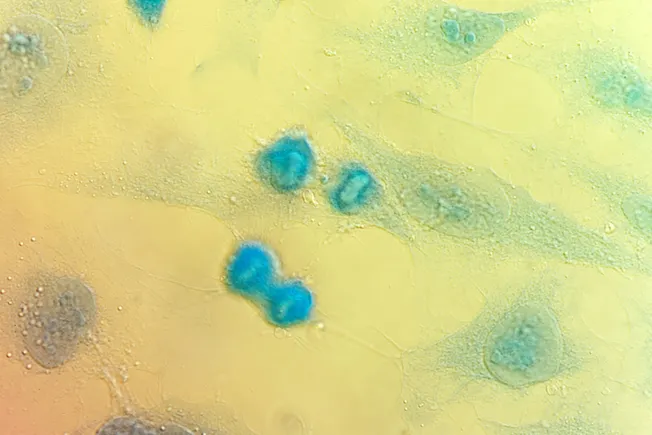 Teal posts data on newly approved at-home cancer screening device