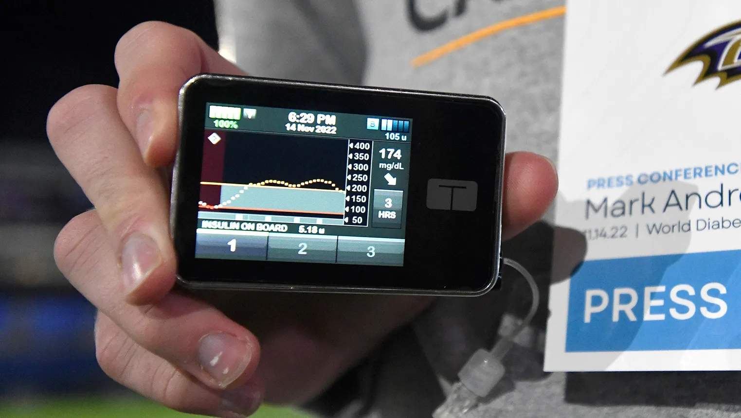 A person holds a square device showing the time, date and insulin on board.