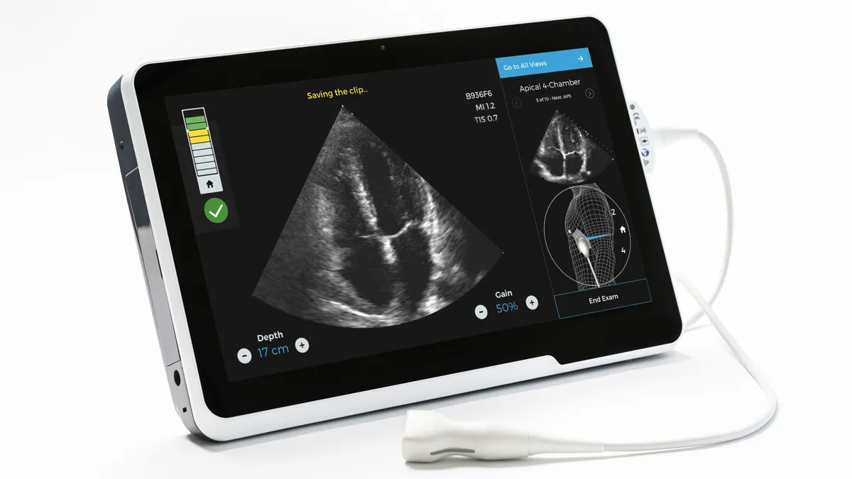 Caption AI software in action showing a successful ultrasound.