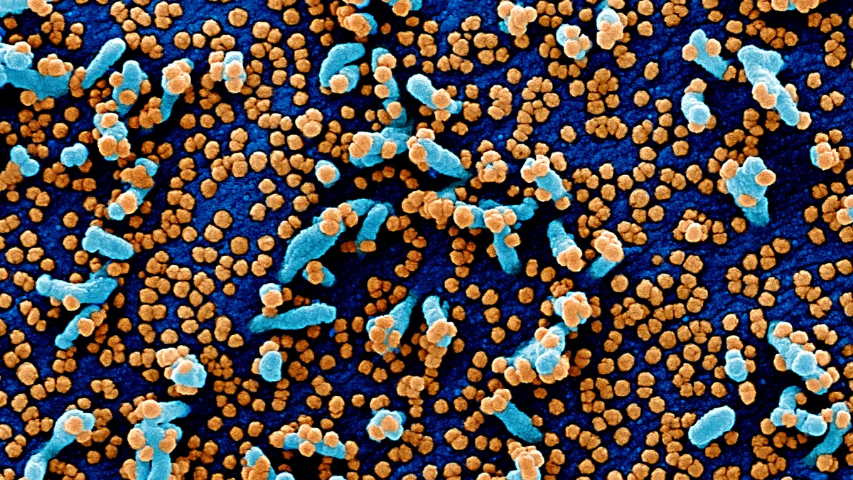 Colorized scanning electron micrograph of a VERO E6 cell heavily infected with SARS-COV-2 virus particles, isolated from a patient sample.