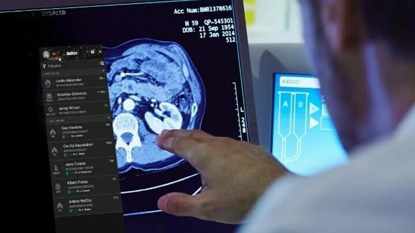 A person points to a scan on a screen.