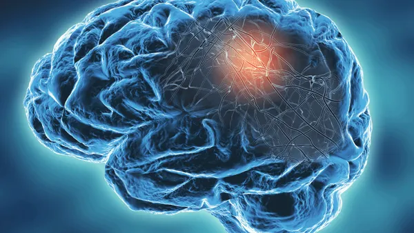A neurodegenerative disease concept illustration