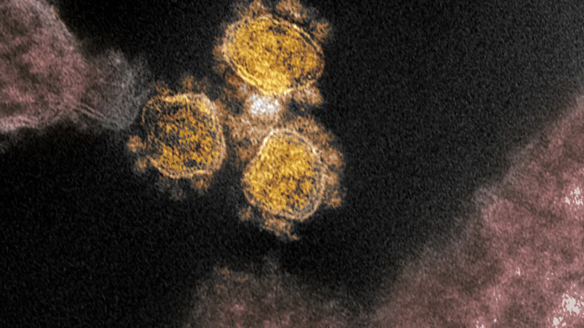 An electron microscope image of SARS-CoV-2, isolated from a patient in the U.S.