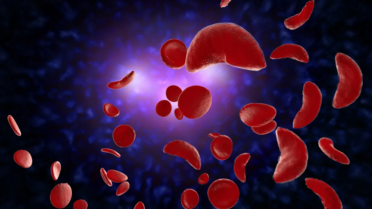 A 3D illustration of sickle cell anemia disease blood cells