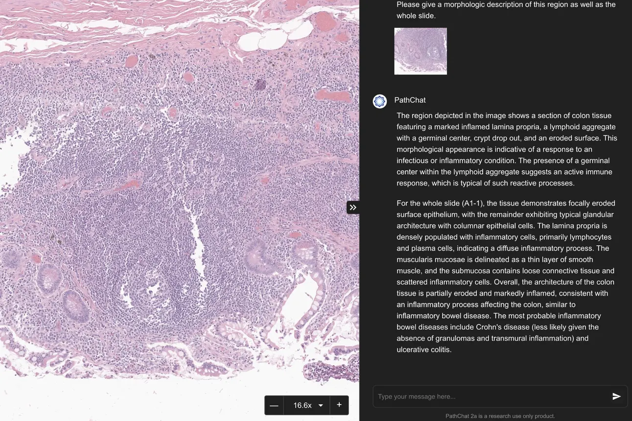 On the left, a screen shows a close up of a pathology slide with pink-stained tissue. On the right, text describes the slide region as a section of colon tissue.