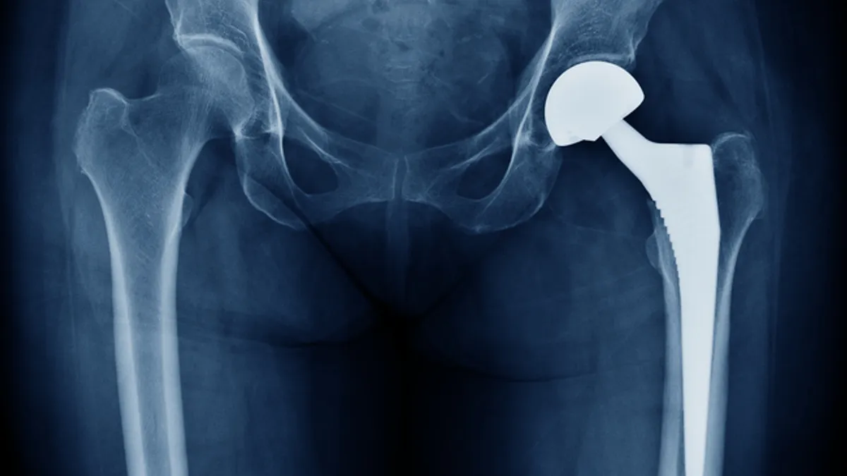 An x-ray image of a person's pelvis shows a hip replacement on the left side.