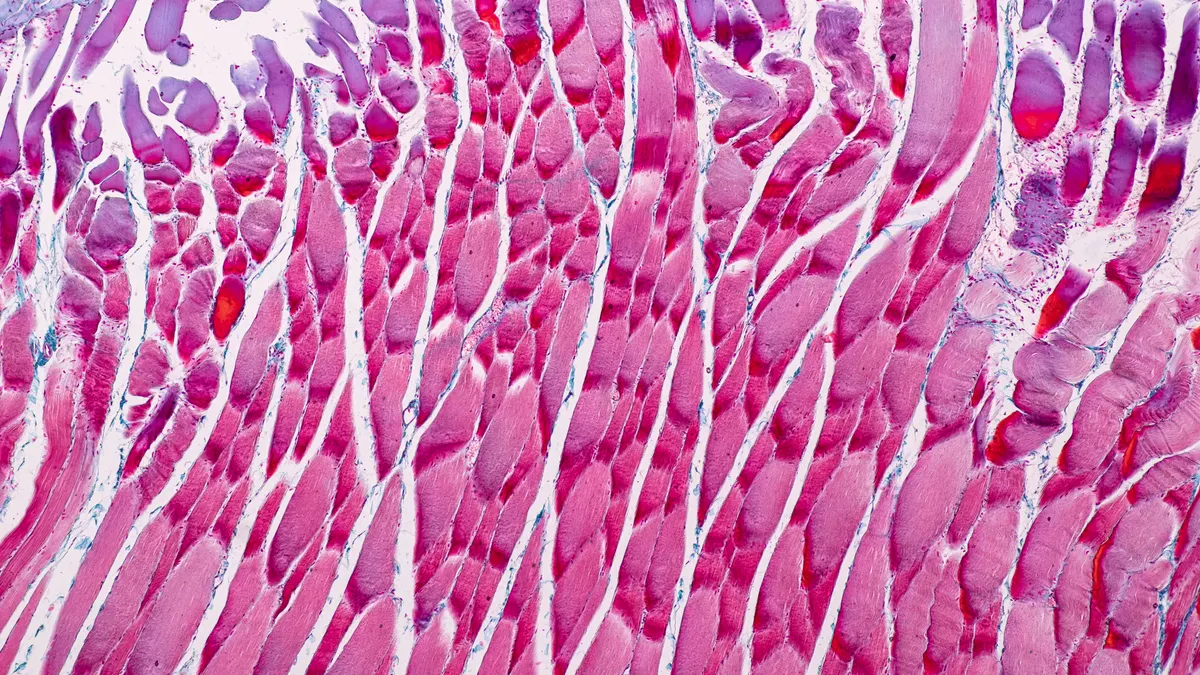 A microscopic image of skeletal muscle tissue, stained red and purple.