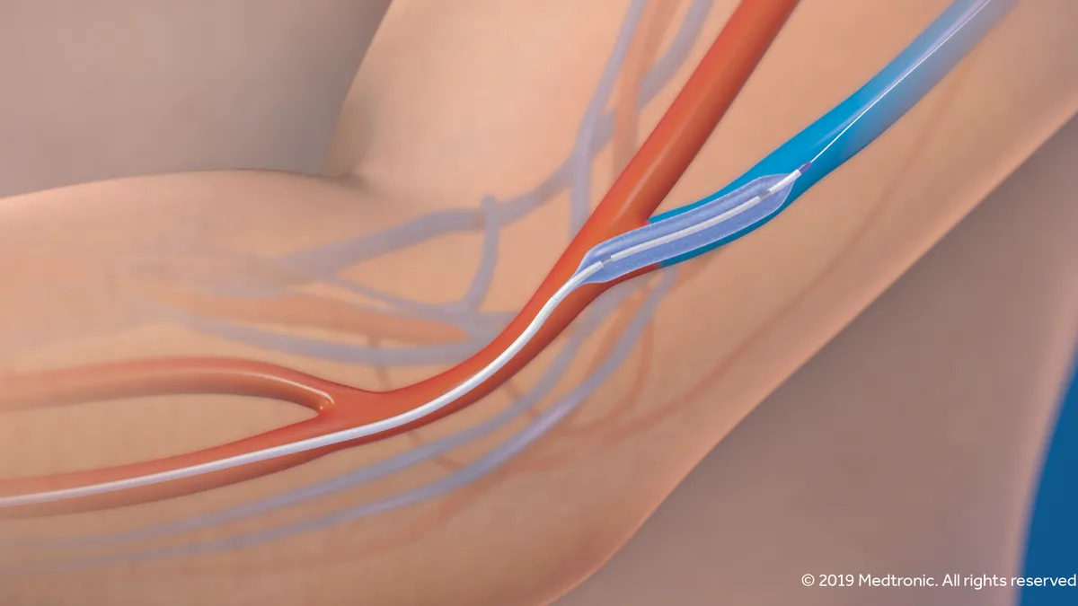 Medtronic IN.PACT AV drug-coated balloon device