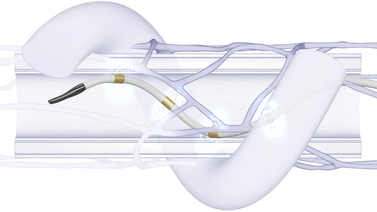 A coil-shaped device is shown moving through a tube with branching structures around it.