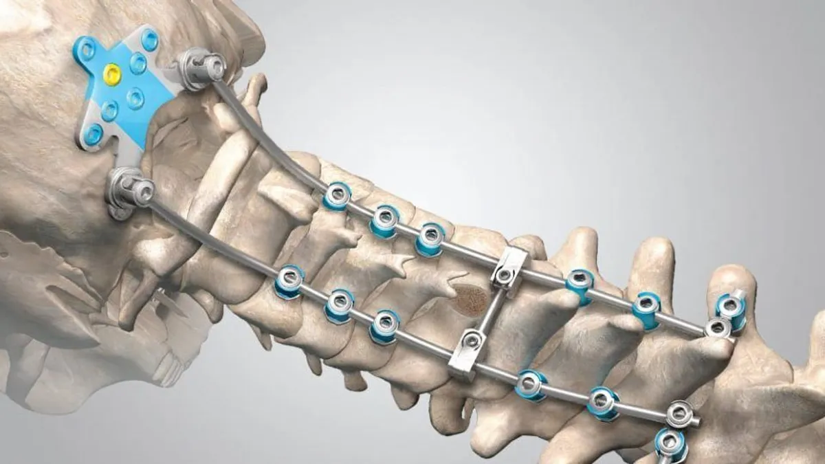 Image shows a spinal medical device.