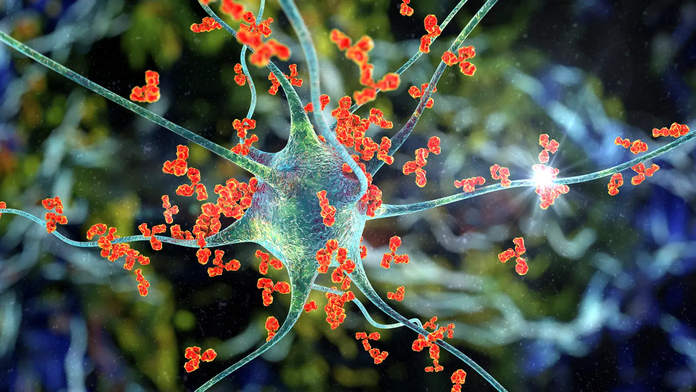 An illustration of antibodies attacking a nerve cell.