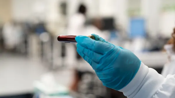 A hand in a blue glove holds a blood sample.