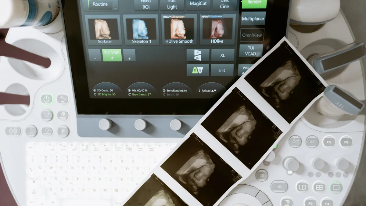 An ultrasound snapshot