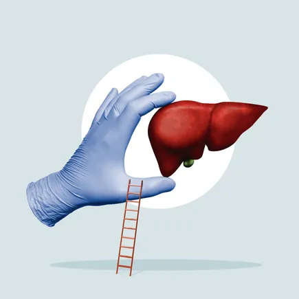 3 late-stage MASH drugs that could rival Rezdiffra