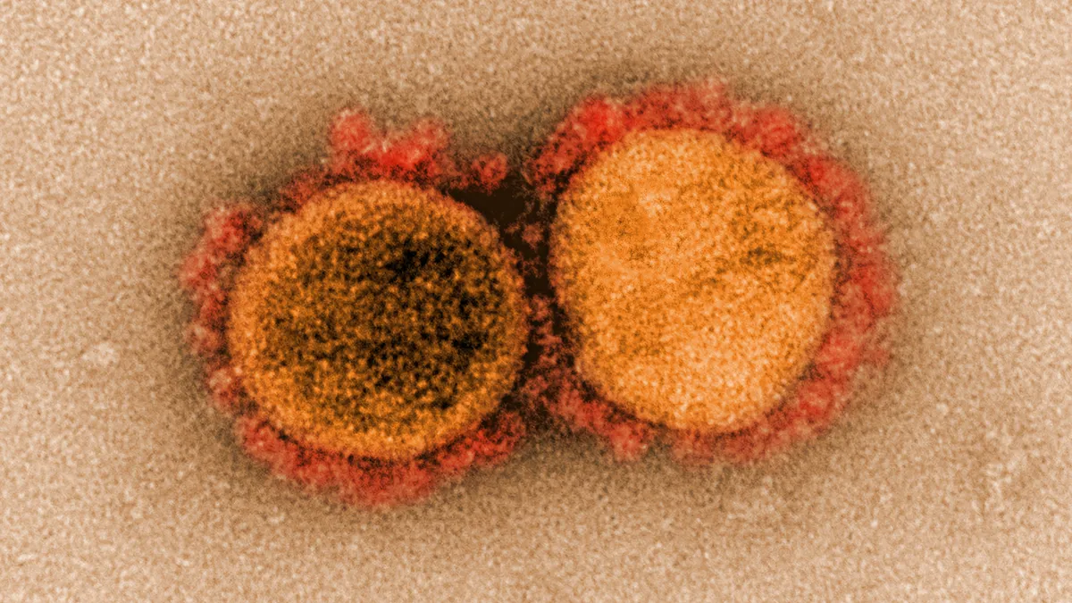 Transmission electron micrograph of SARS-CoV-2 virus particles, isolated from a patient