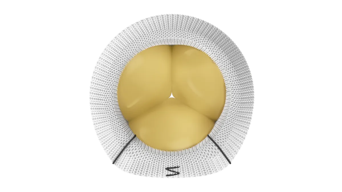Triformis Resilia surgical tricuspid valve replacement