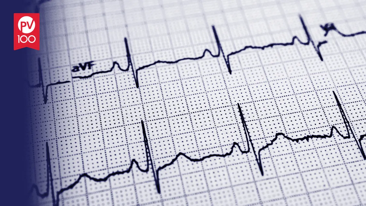 heart monitor chart