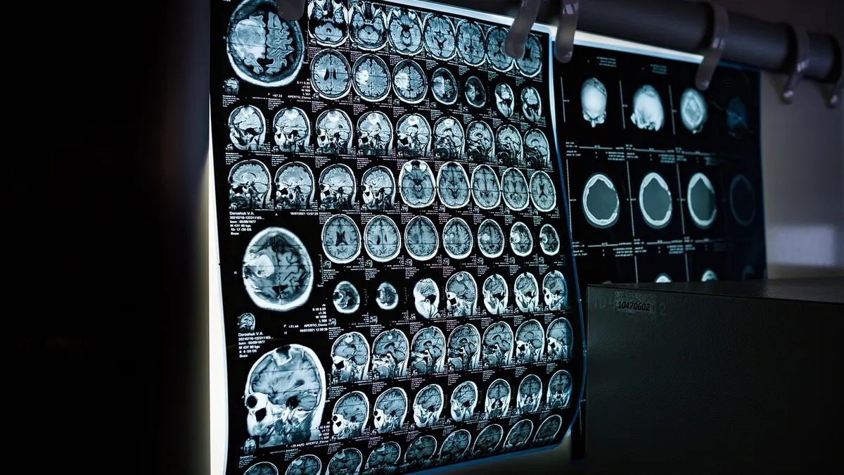 Medical scan images