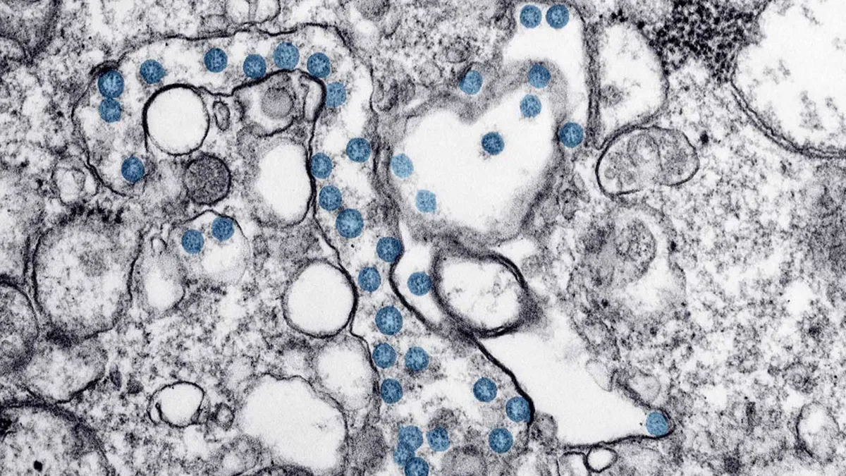 covid-19 coronavirus microscopic image with blue colored viral particles