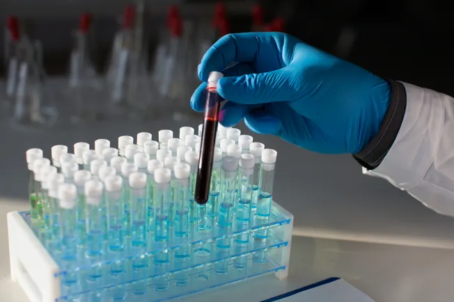 Tempus to acquire cancer test maker Personalis for $1.5B