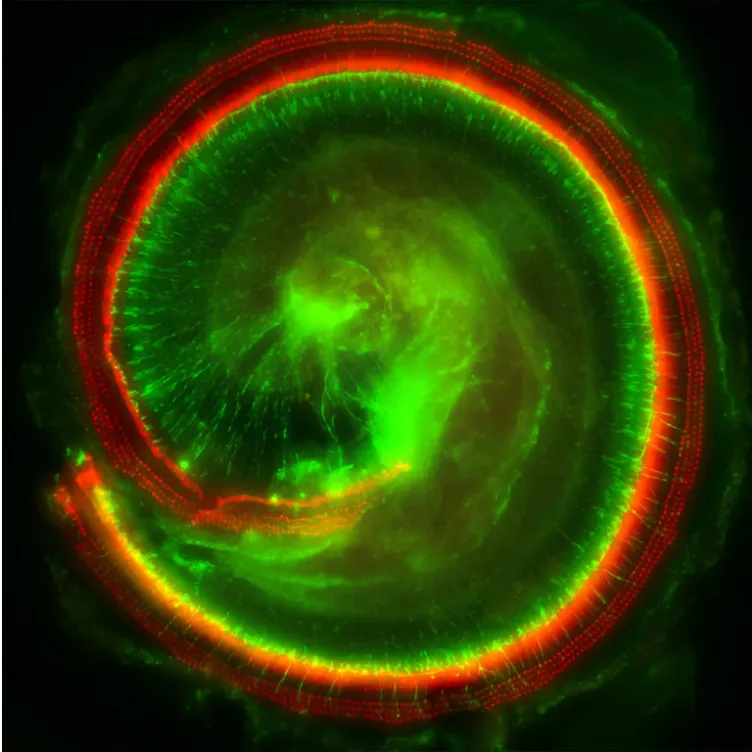 A microscope image of a cochlea