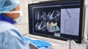 A physician in blue scrubs and a mask looks at Philips' DeviceGuide images on a large screen.