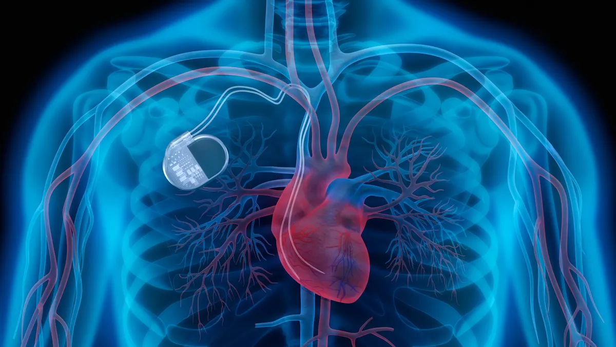 An artists rendering of a human body showing the heart in red and a pacemaker device with antennae