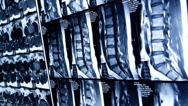 Imaging scans of a human spine are illuminated from behind for review.
