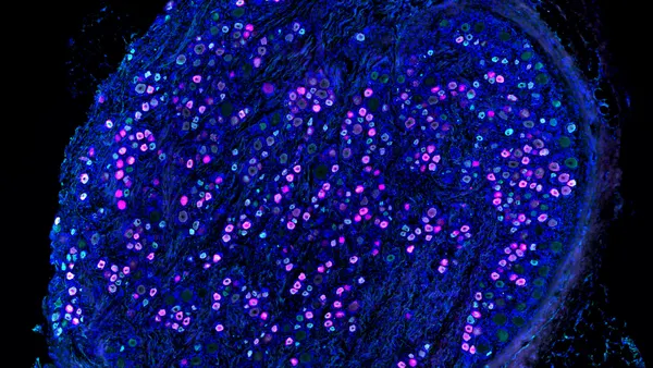 An image of sodium ion channels