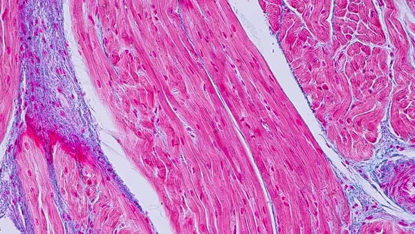 A cardiac tissue sample viewed through a microscope.