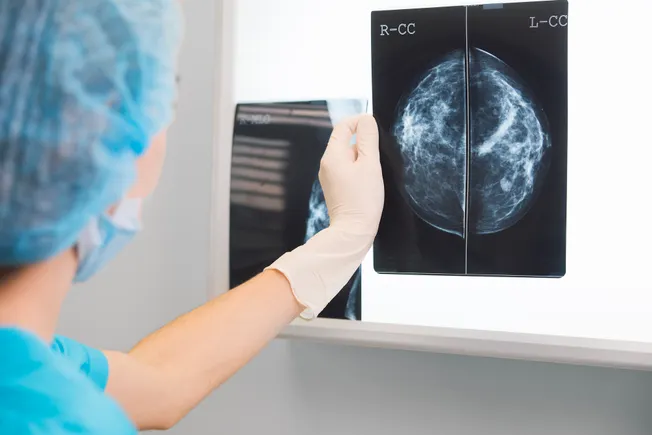 Clairity receives FDA OK for breast cancer risk prediction tool