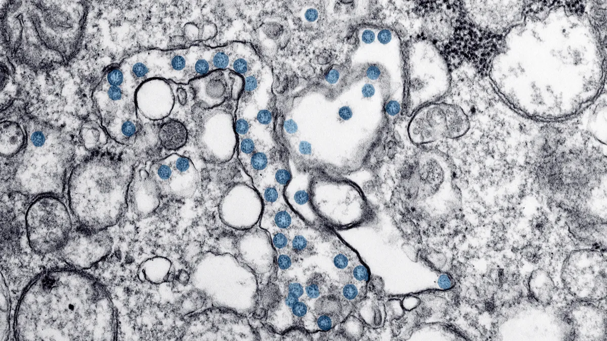 Transmission electron microscopic image of an isolate from the first U.S. case of COVID-19, formerly known as 2019-nCoV. The spherical viral particles, colorized blue, contain cross-section through th