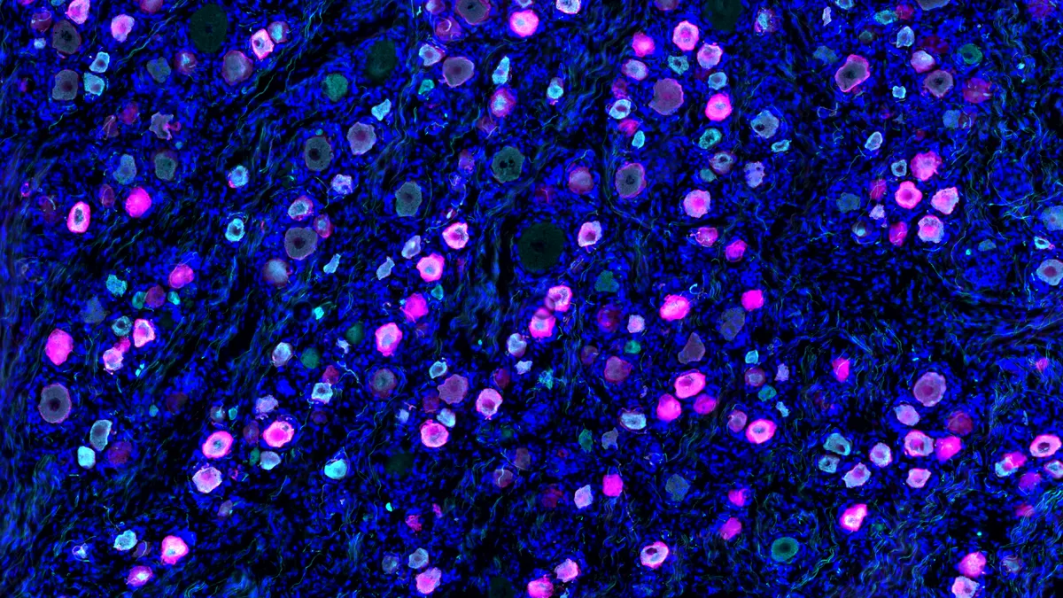 A microscopic view of a nerve cell, containing magenta dots on a blue and black wave texture background.