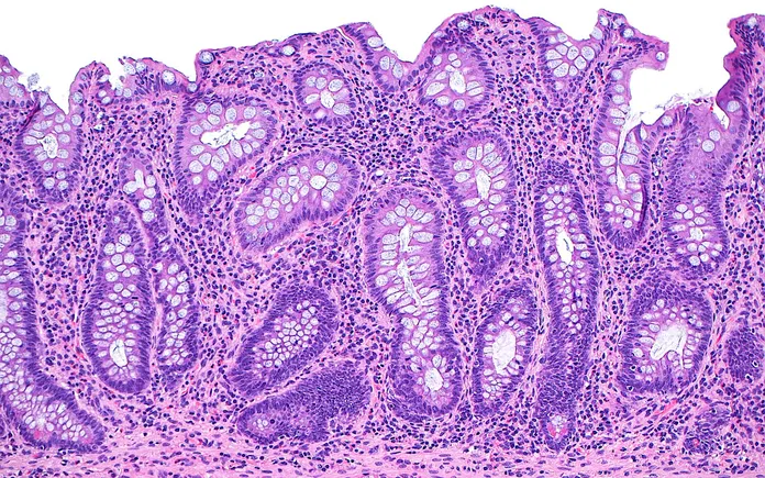 cAMPfield lands $180M  to build gut disease drug