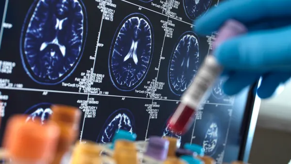 A gloved scientist holds a blood sample in front of a monitor displaying a brain MRI scan.