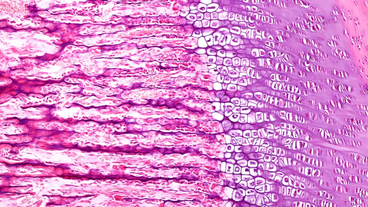 A micrograph of an epiphyseal growth plate, stained in color to show layers of cartilage