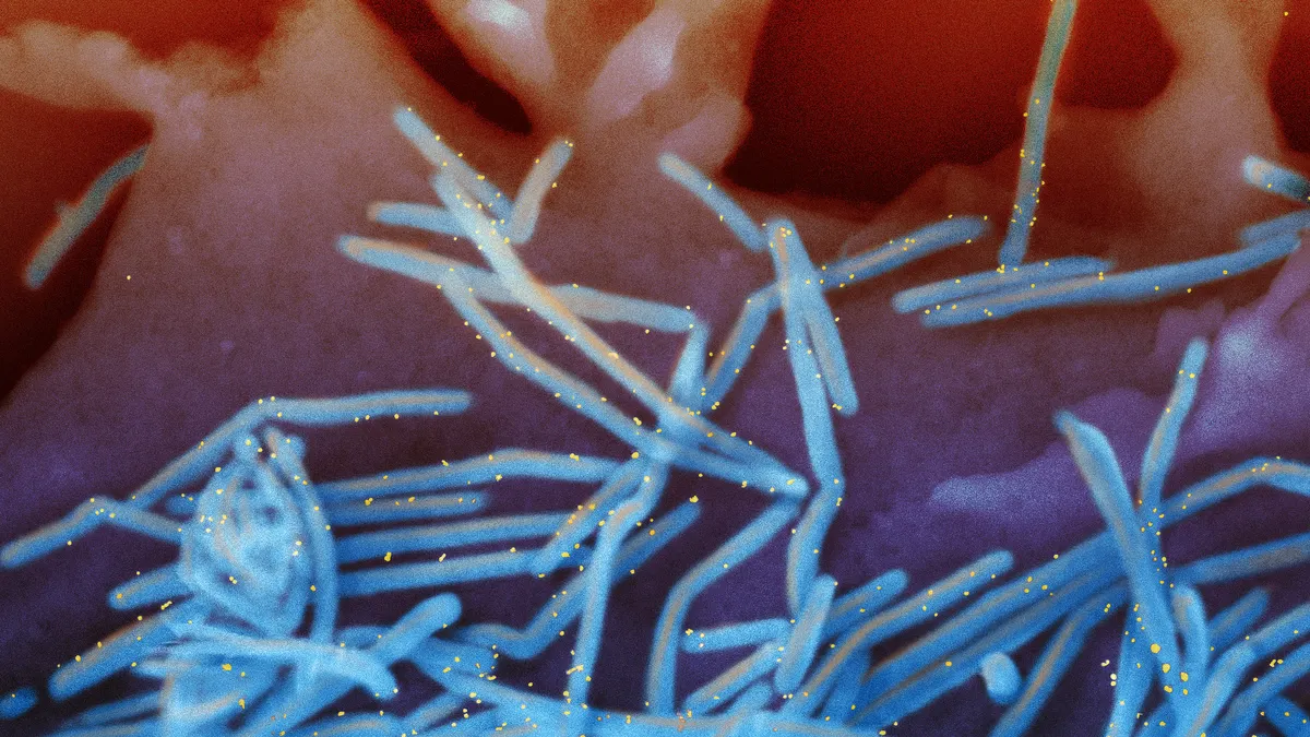 Human respiratory syncytial virus virions are shedding from the surface of human lung cells.