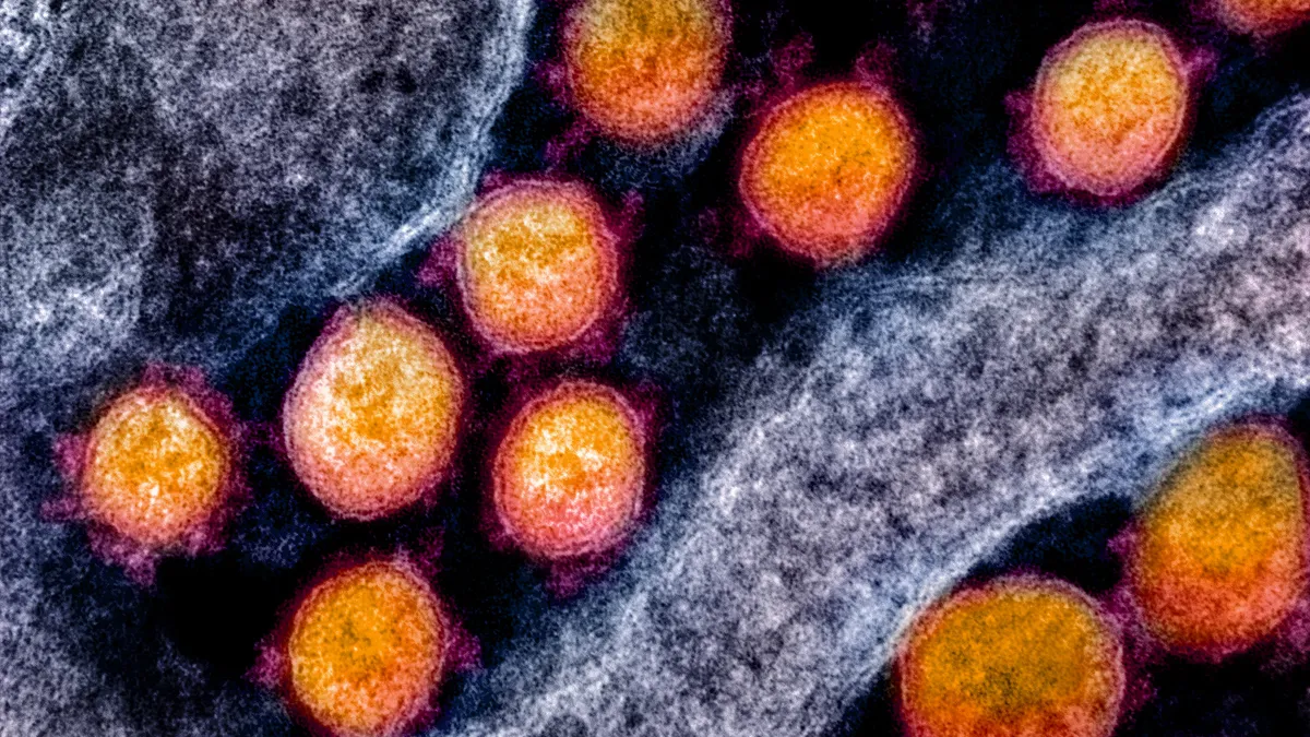 Transmission electron micrograph of SARS-CoV-2 virus particles, isolated from a patient.