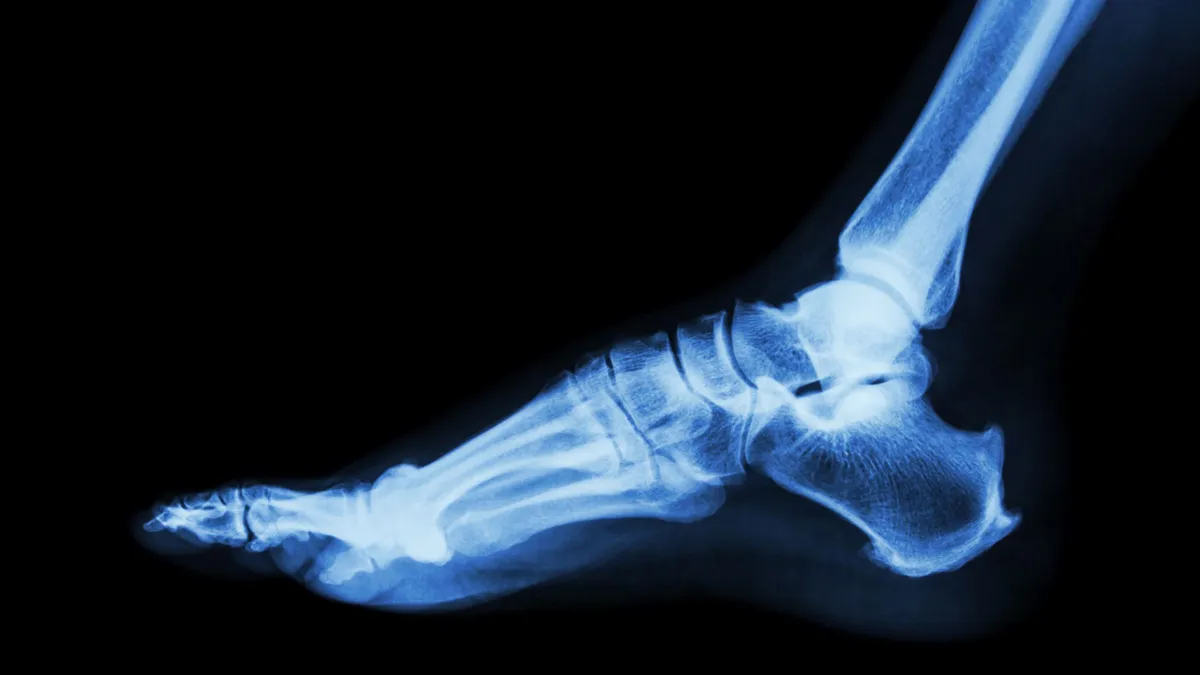 An x-ray image of the ankle and foot.