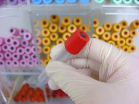 Patients may now receive lab test results directly | Healthcare Dive