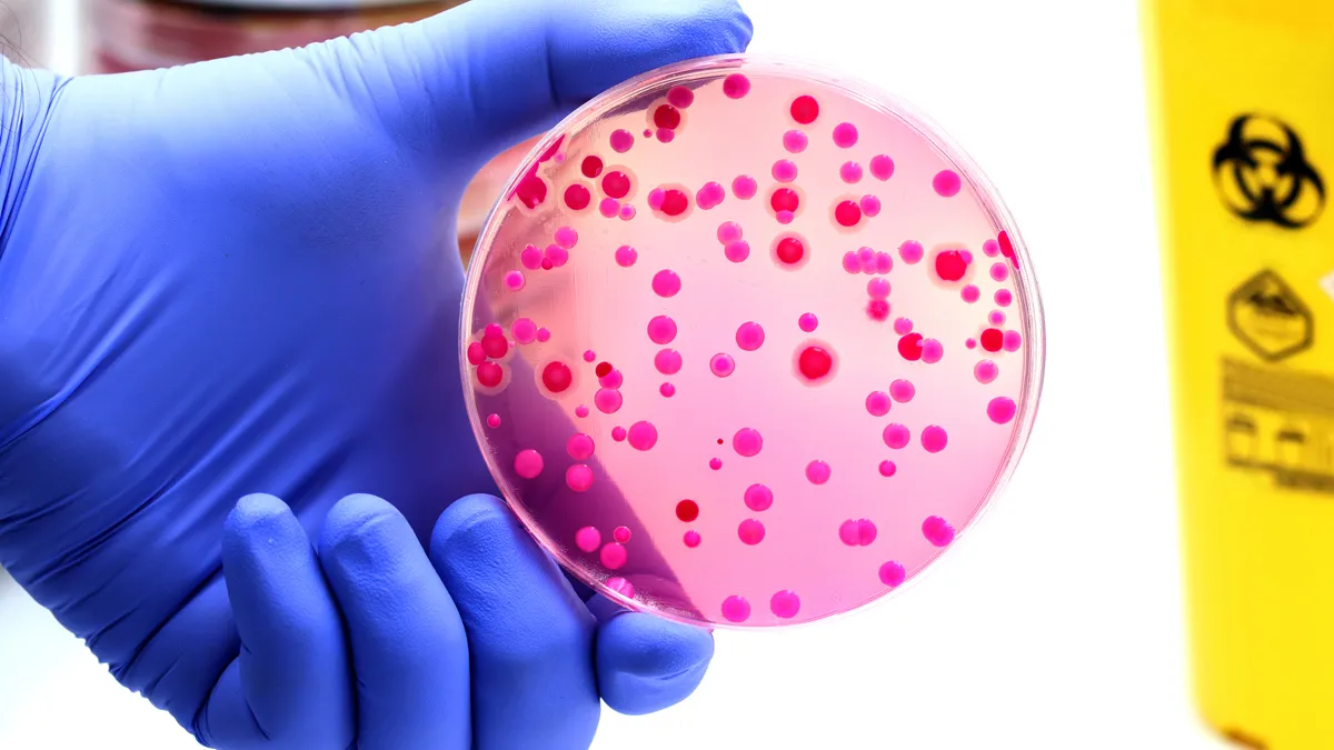 A person wearing a purple latex glove holds a petri dish with pink and red spots vertically with their thumb and index finger.