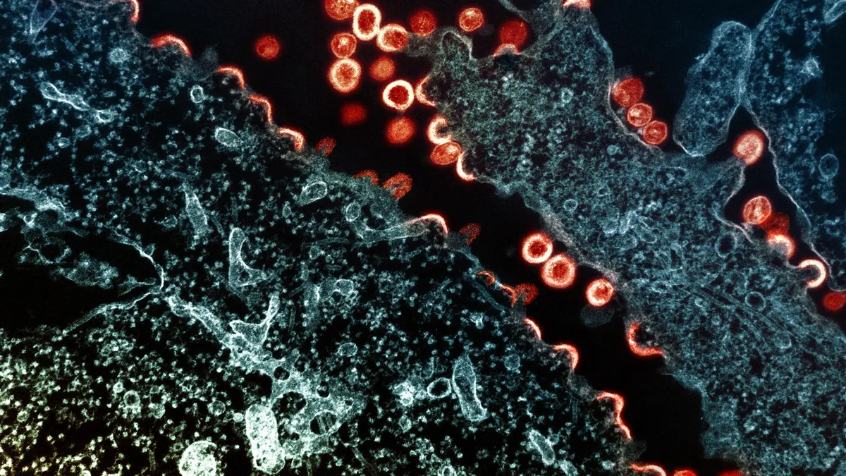 HIV-1 virus particles replicate in an infected H9 cell in this micrograph image.