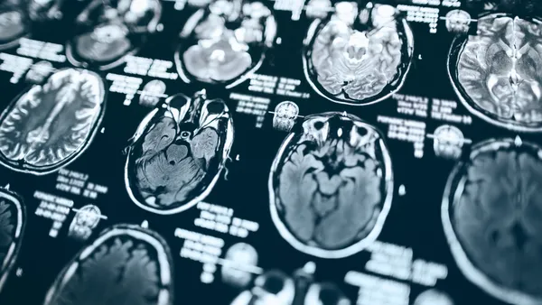 A human brain is imaged with a MRI scan.