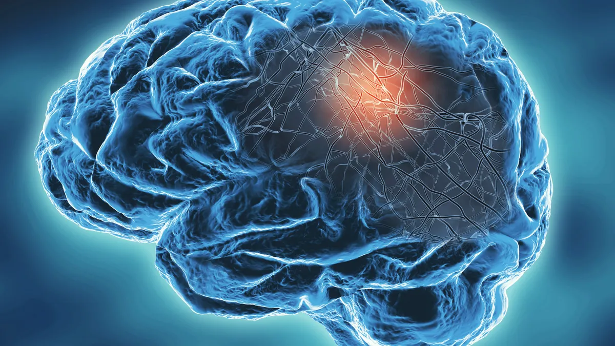 A neurodegenerative disease concept illustration