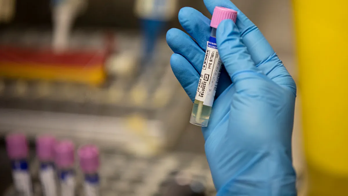 Close up of a person wearing blue gloves holding a vial for a monkeypox test.